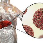 Virus hepatitidy A napadající játra – prevence hepatitidy A jako klíč k ochraně zdraví