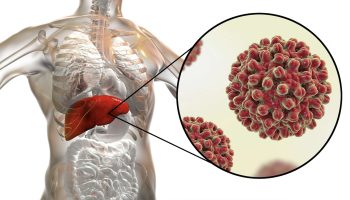 Virus hepatitidy A napadající játra – prevence hepatitidy A jako klíč k ochraně zdraví